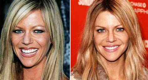 kaitlin olsen plastic surgery|Kaitlin Olsons Plastic Surgery: What Other。